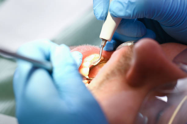 Best Chipped Tooth Repair Near Me  in Valle Vista, CA