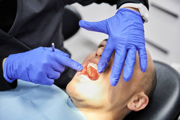 Best Broken Tooth Emergency  in Valle Vista, CA